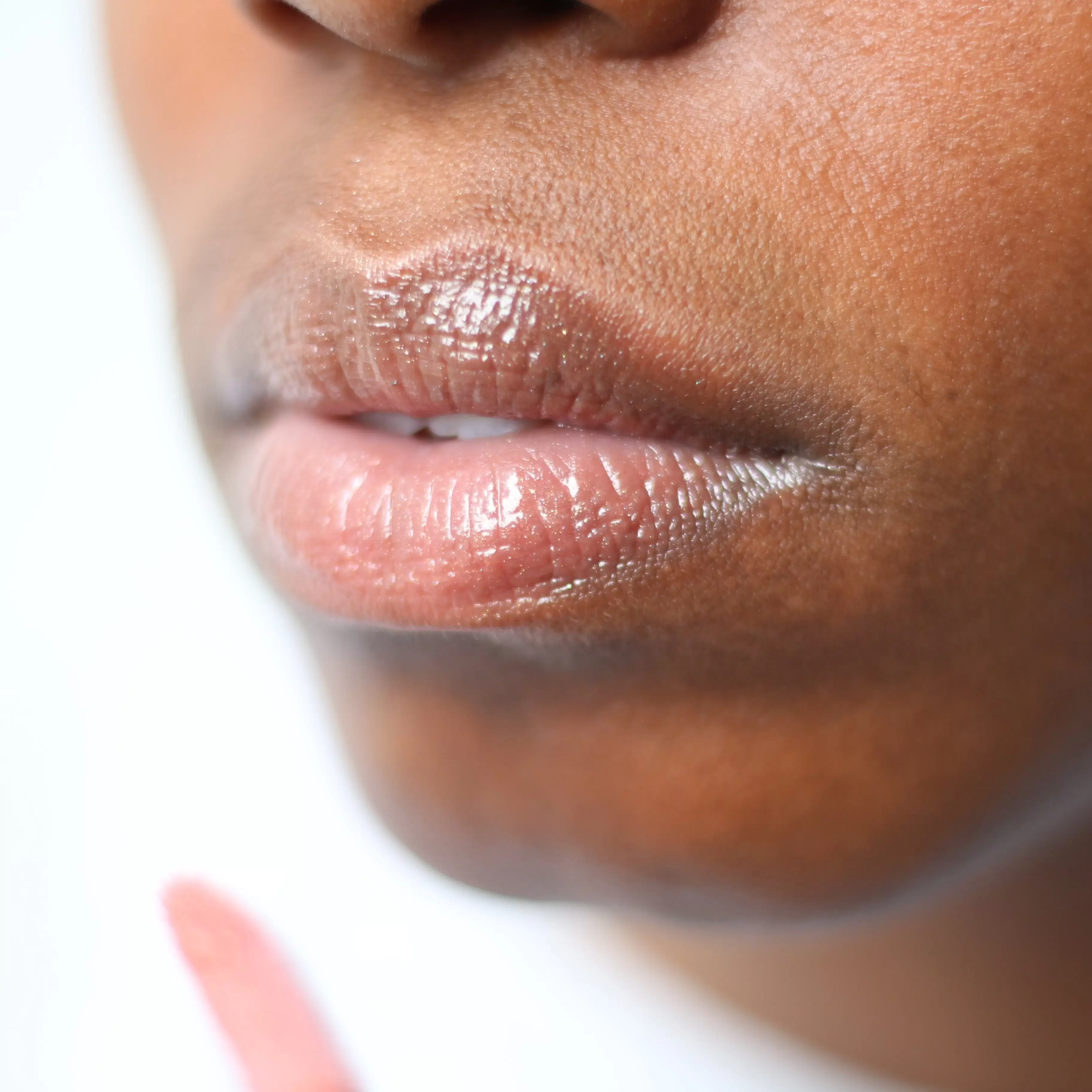 Needle free lip filler at Dr Tijion Esho's clinic